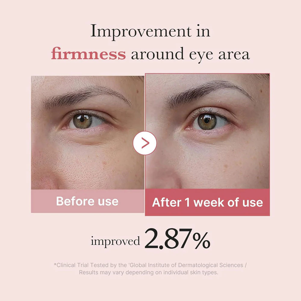 Medicube PDRN Pink Peptide Eye Cream 30ml